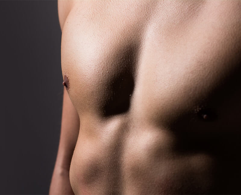 Gynecomastia Dubai 15