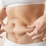 Lipo Abdominoplasty in Islamabad