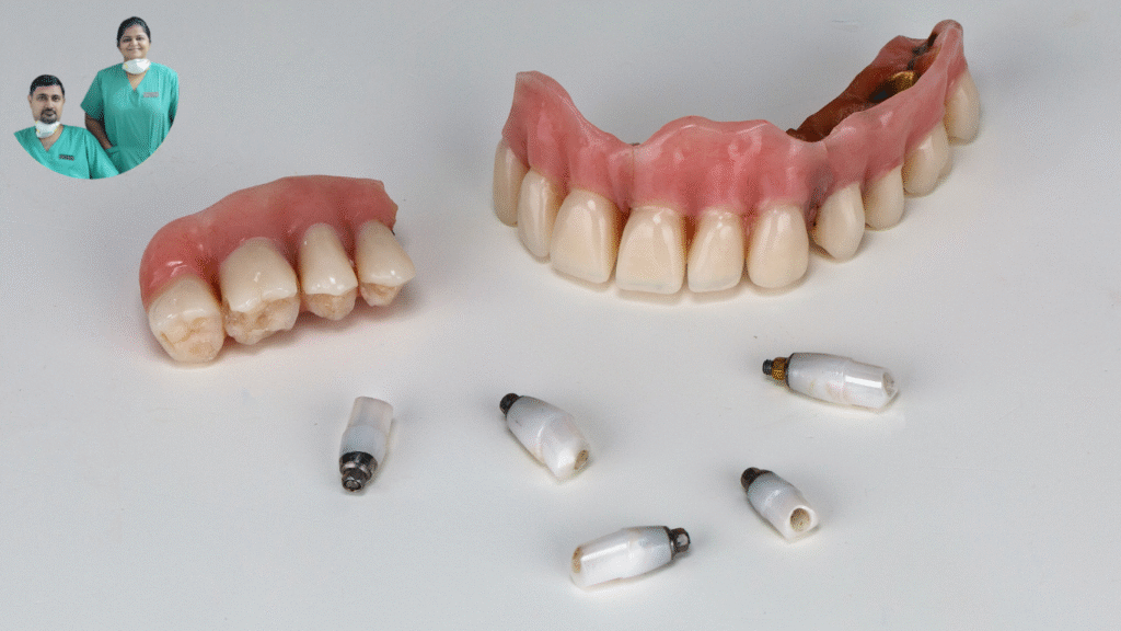 Basal Implant for Fixed Teeth