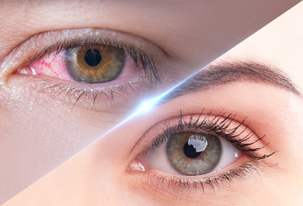 Ayurvedic Eye Diseases Treatment in Dubai