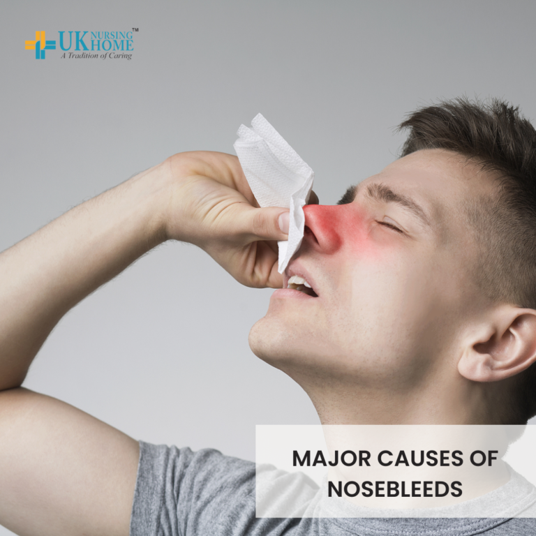 Major causes of Nosebleeds