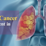 Lung Cancer Treatment in Noida
