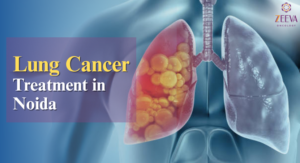 Lung Cancer Treatment in Noida