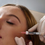 Cheek Dermal Fillers