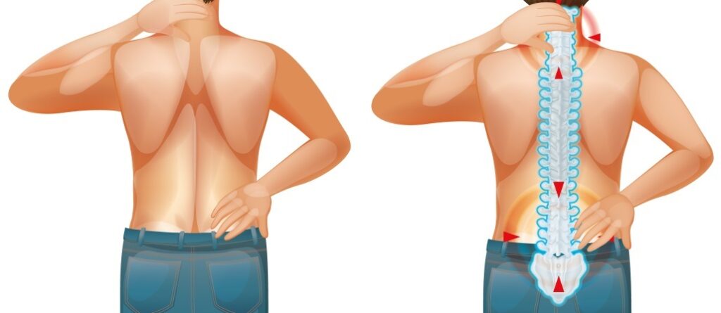 Male human with back pain