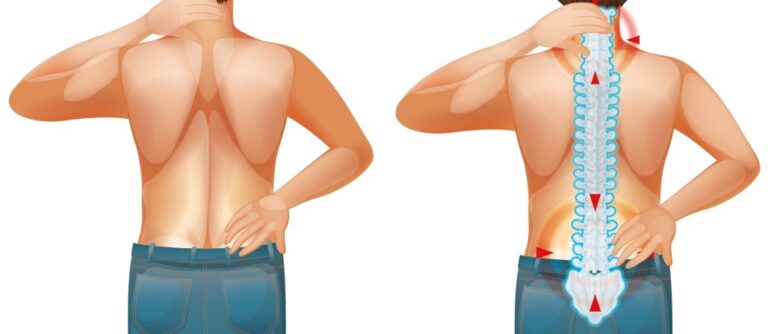 Male human with back pain
