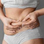 vaser liposuction in dubai