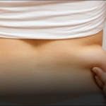Back Liposuction In Dubai