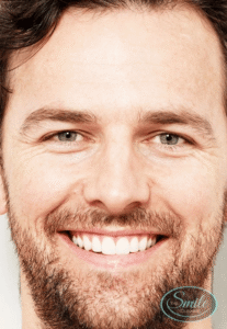 Cosmetic Dentistry Perth