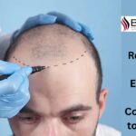 hair restoration clinic