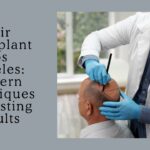 hair transplant los angeles
