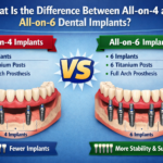 dental implants fuquay varina, dental implants, dental implants treatment,