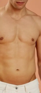 شفط الدهون في جدة