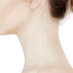 Neck Liposuction In Dubai