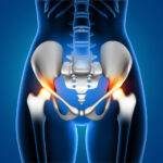 affordable hip injuries treatment