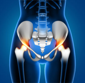 affordable hip injuries treatment