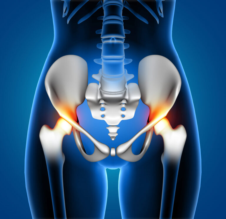 affordable hip injuries treatment