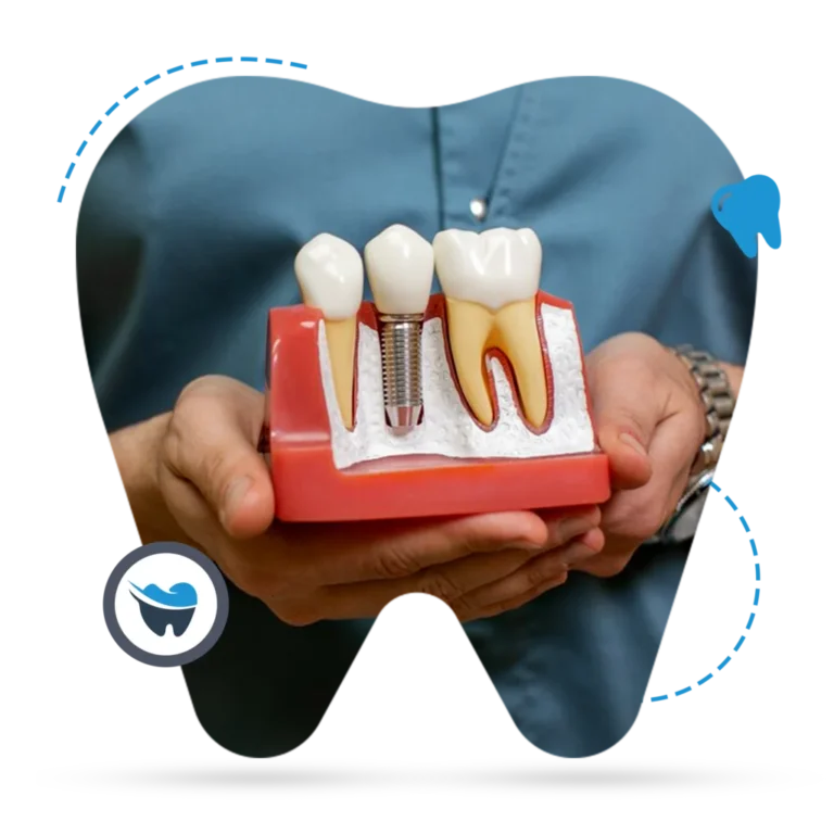 Dental-Implants-1024x1024
