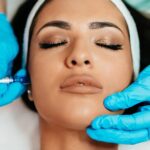 Facial Microneedling in Lauderdale Beach