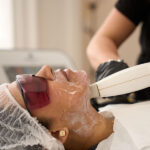 Laser For Pigmentation In London