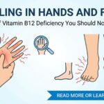 Tingling in Hands and Feet Signs of Vitamin B12 Deficiency You Should Not Ignore