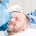 best-hair-transplant-surgeon-min