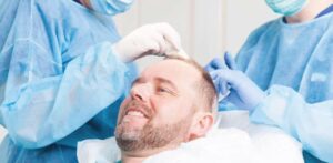 best-hair-transplant-surgeon-min