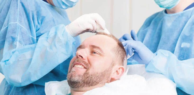best-hair-transplant-surgeon-min