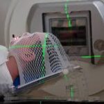 Radiation Therapy in India