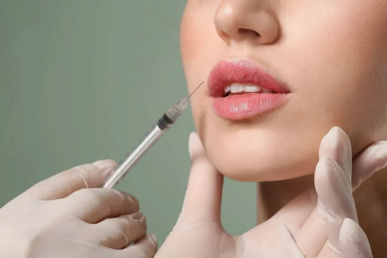 lip fillers in Dubai