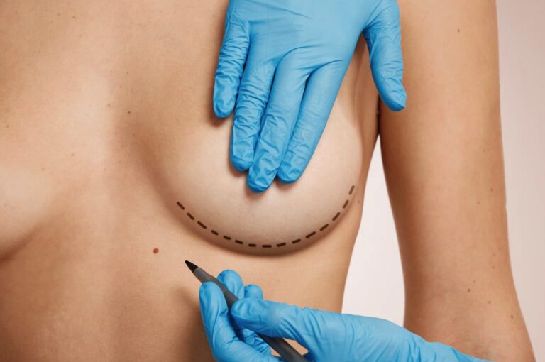 Breast Lift in Dubai