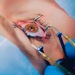 Top Femto LASIK Surgery in Delhi for Glass-Free Vision | Shreya Eye Centre