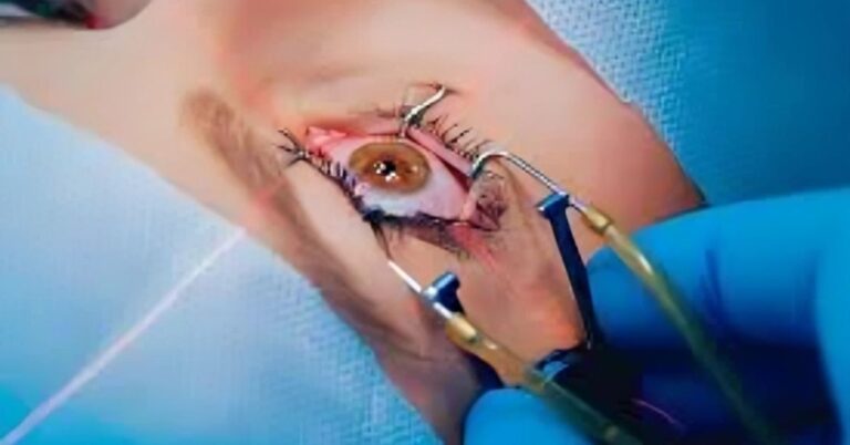 Top Femto LASIK Surgery in Delhi for Glass-Free Vision | Shreya Eye Centre