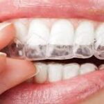 Invisalign Malaysia
