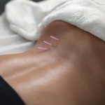 Manual Therapy in Dubai