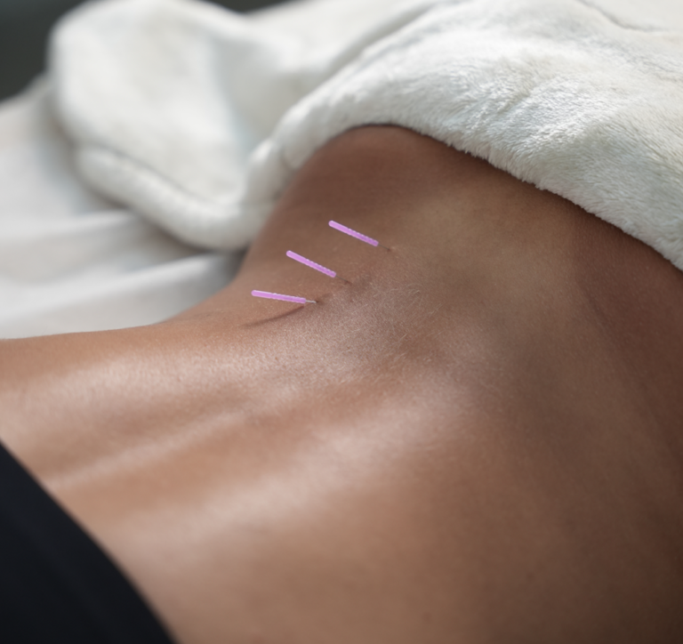Manual Therapy in Dubai