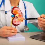 kidney stone treatment cost in Dubai