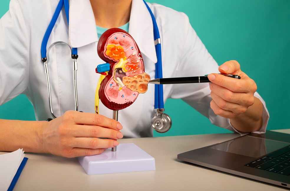 kidney stone treatment cost in Dubai