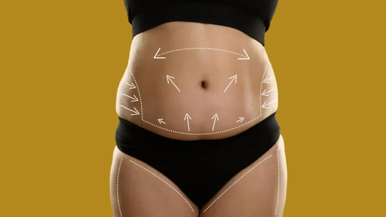 tummy tuck surgery in Islamabad
