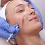 Acne Scars Treatment In London