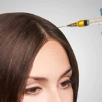 PRP Hair Treatment in Dubai