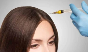 PRP Hair Treatment in Dubai