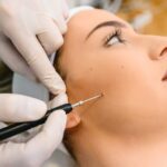 Mole Removal in London