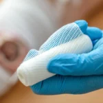 mobile wound care nurse services Troy