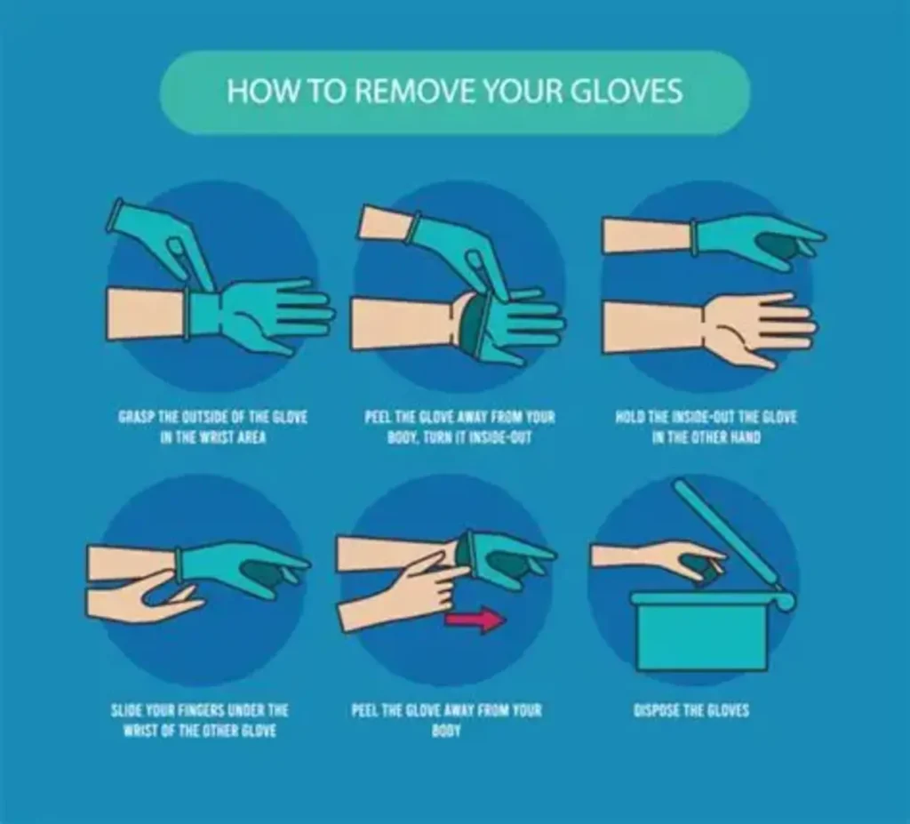 6-Step Method for Hygienic Glove Removal