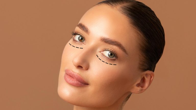 Eyelid-Surgery-768x432