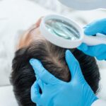 DHI Direct Hair Implant in Dubai