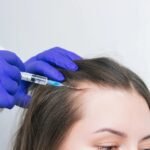 Stem Cell Hair Transplant in Dubai