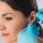 Discover Expert Otoplasty Surgery at Enfield Royal Clinic