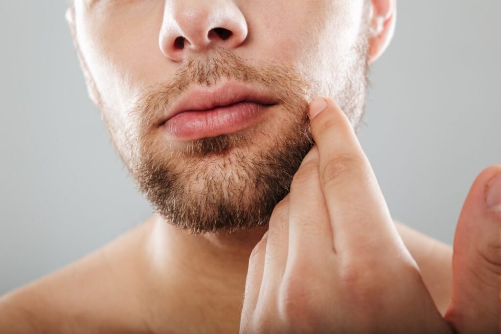 Beard Hair Transplant in Dubai